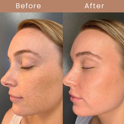 Mimic Foundation