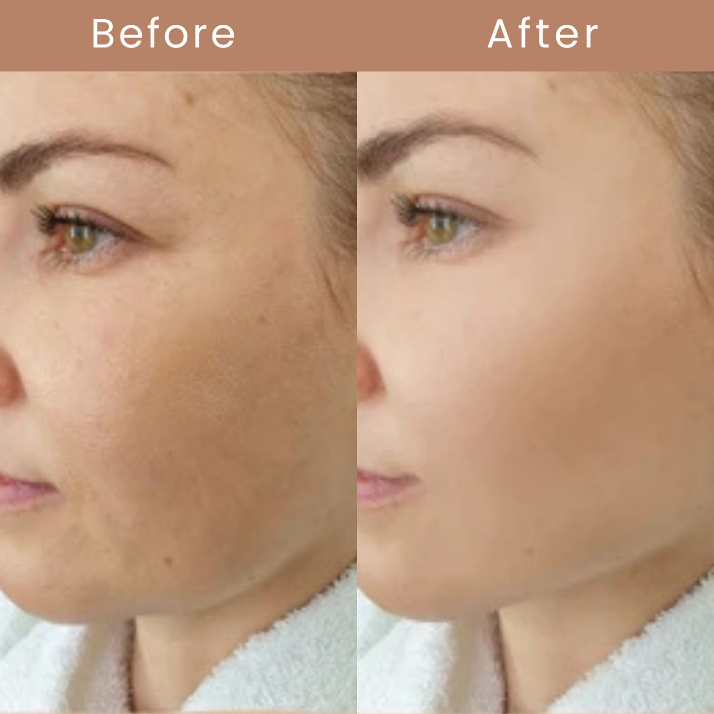 Mimic Foundation